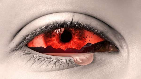 Лучшие глазные капли при ожоге глаз: виды и свойства